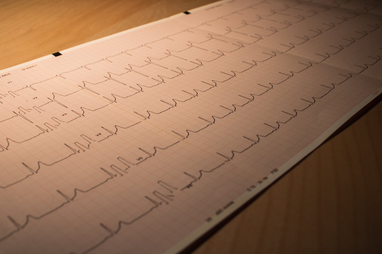 Home Close-up of an ECG printout depicting heart activity, placed on a wooden surface.
